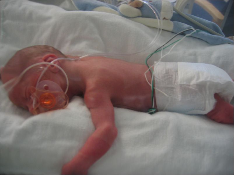 Owen off CPAP, with binky, sleeping